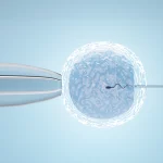 A Complete Guide to IVF: Everything you need to know about In Vitro Fertilization