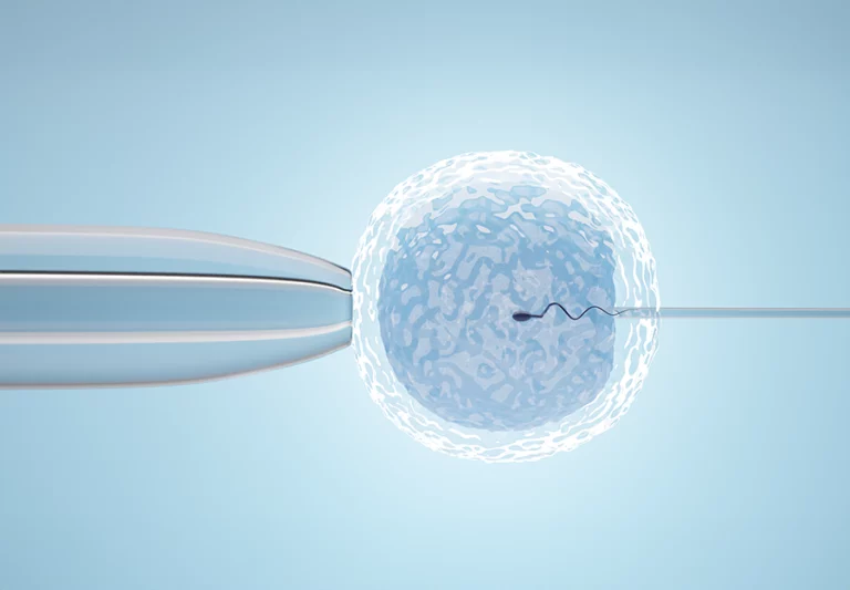 A Complete Guide To Ivf: Everything You Need To Know About In Vitro Fertilization