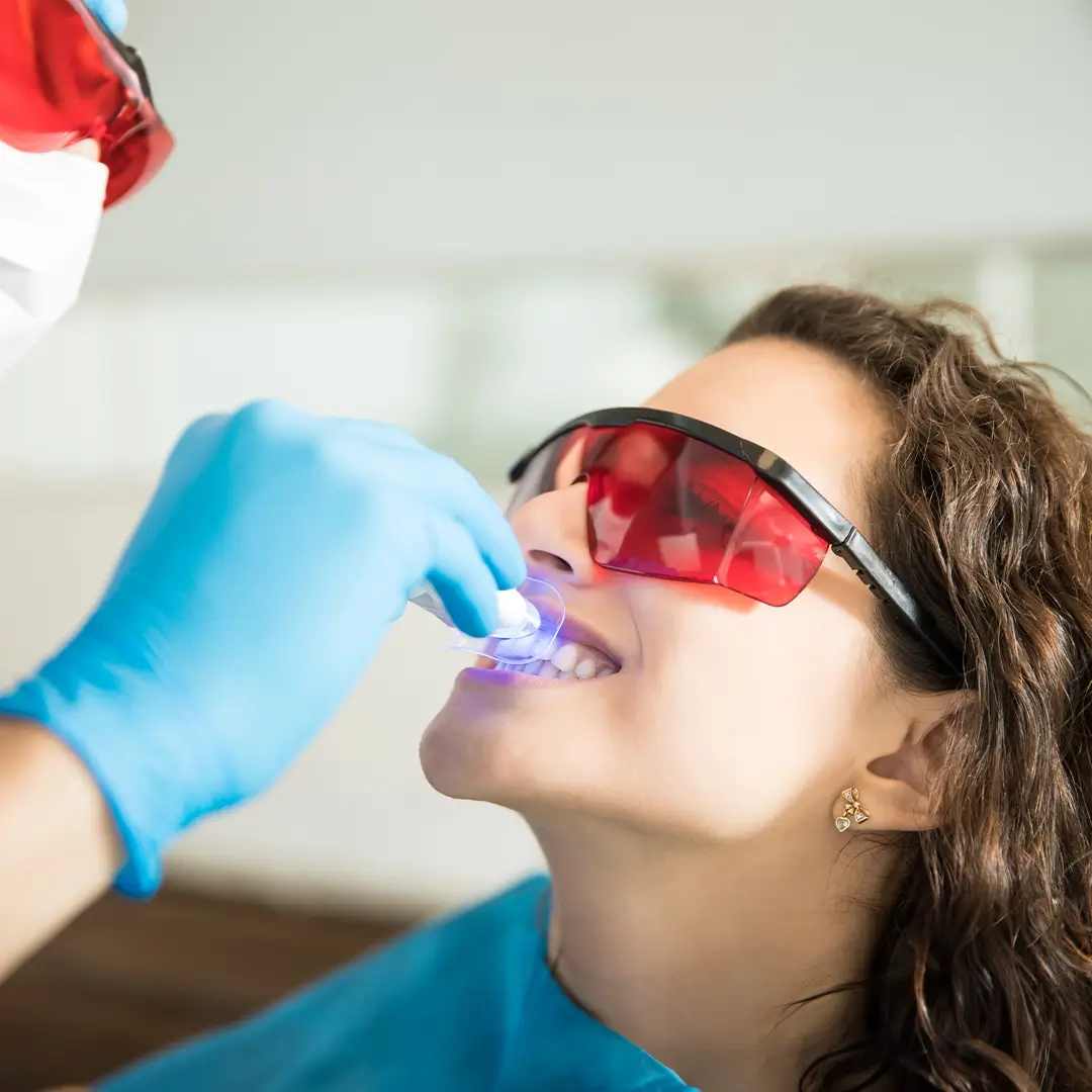 Teeth-Whitening-In-Turkey (6)