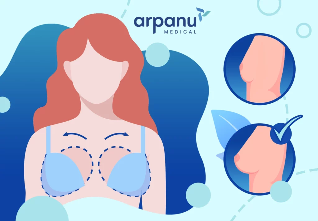 Breast Augmentation 1